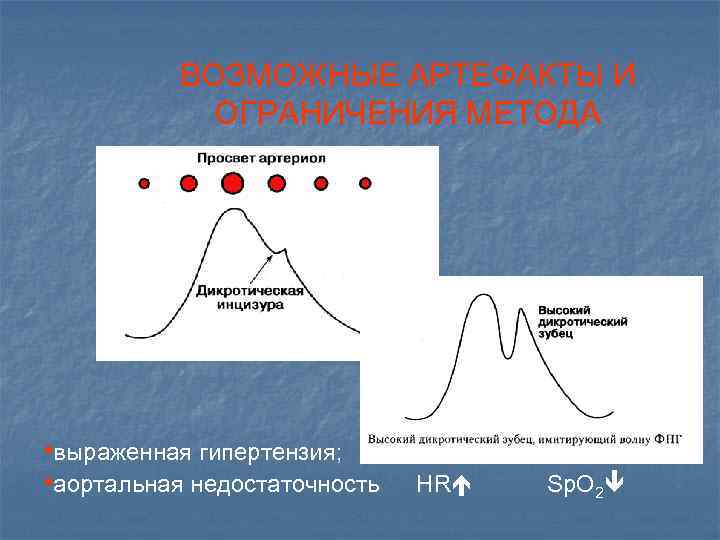 ВОЗМОЖНЫЕ АРТЕФАКТЫ И ОГРАНИЧЕНИЯ МЕТОДА • выраженная гипертензия; • аортальная недостаточность HR Sp. O