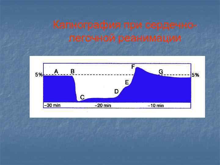 Капнография при сердечнолегочной реанимации 
