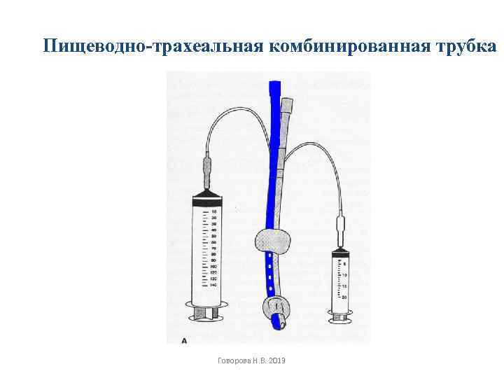 Пищеводно-трахеальная комбинированная трубка Говорова Н. В. 2013 