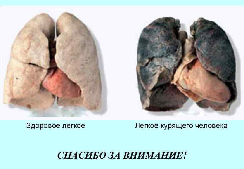 Здоровое легкое Легкое курящего человека СПАСИБО ЗА ВНИМАНИЕ! 
