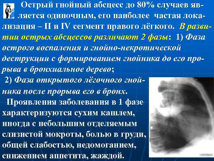  Острый гнойный абсцесс до 80% случаев яв- ляется одиночным, его наиболее частая локализация