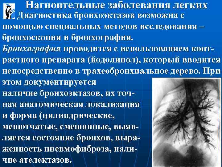  Нагноительные заболевания легких Диагностика бронхоэктазов возможна с помощью специальных методов исследования – бронхоскопии