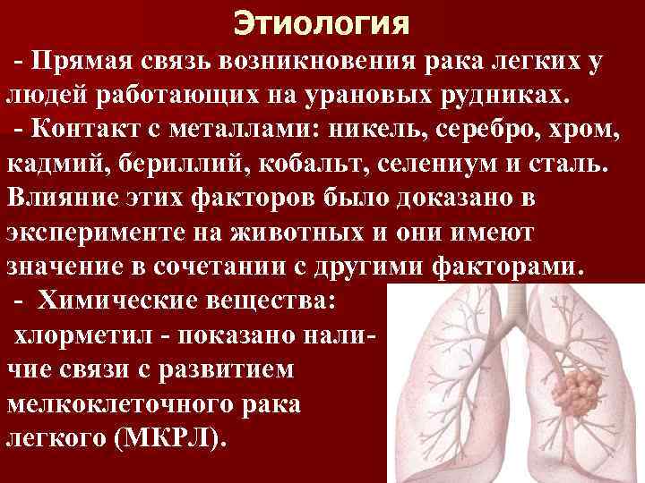 Этиология - Прямая связь возникновения рака легких у людей работающих на урановых рудниках. -
