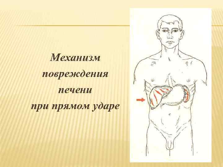 Механизм повреждения печени прямом ударе 