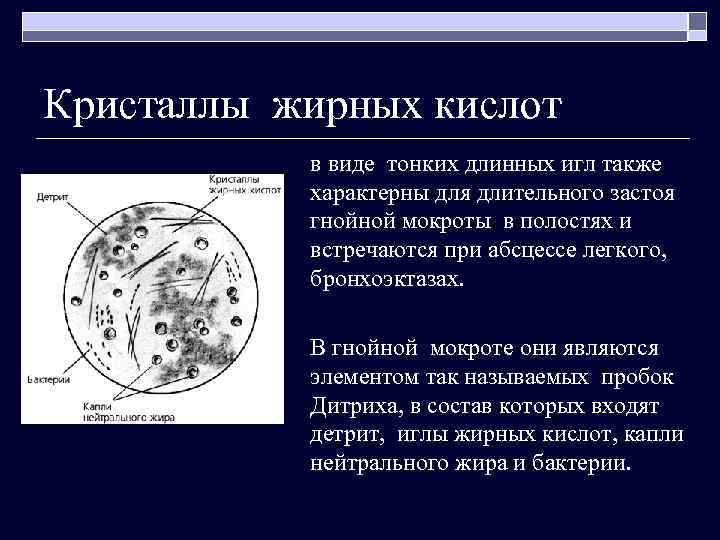 Кристаллы жирных кислот в виде тонких длинных игл также характерны для длительного застоя гнойной