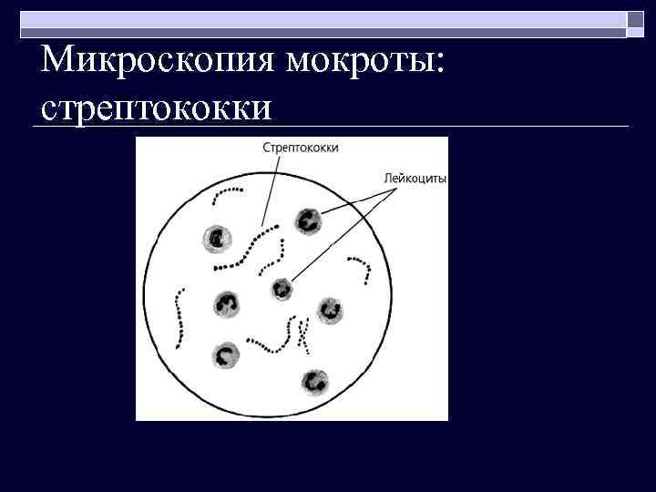 Микроскопия мокроты: стрептококки 