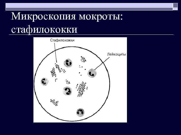 Микроскопия мокроты: стафилококки 