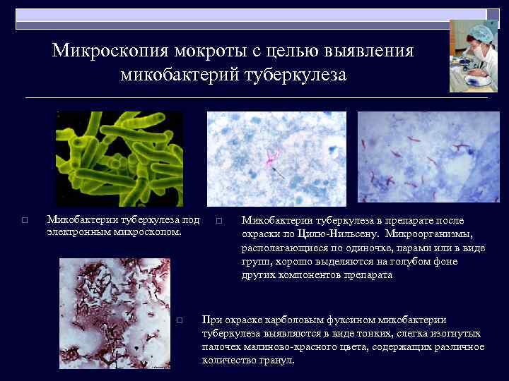 Микроскопия мокроты с целью выявления микобактерий туберкулеза o Микобактерии туберкулеза под электронным микроскопом. o