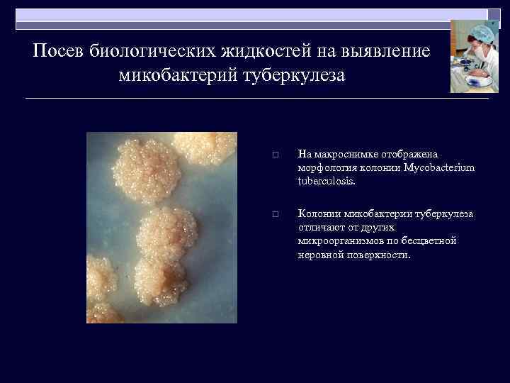 Посев биологических жидкостей на выявление микобактерий туберкулеза o На макроснимке отображена морфология колонии Mycobacterium
