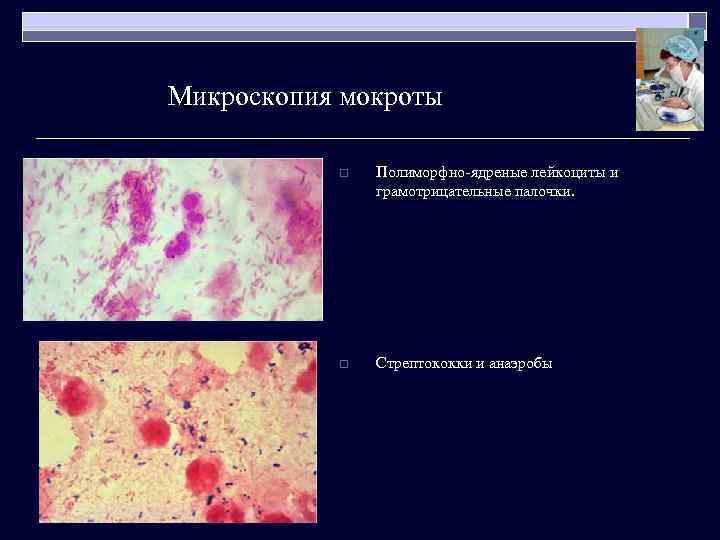 Микроскопия мокроты o Полиморфно-ядреные лейкоциты и грамотрицательные палочки. o Стрептококки и анаэробы 