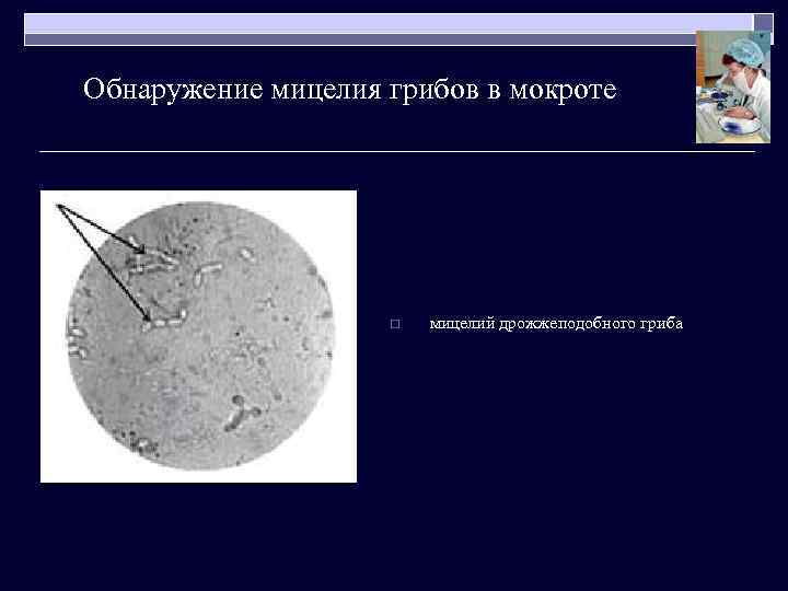 Обнаружение мицелия грибов в мокроте o мицелий дрожжеподобного гриба 