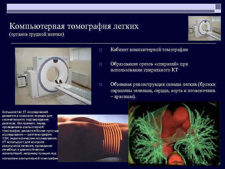 Компьютерная томография легких (органов грудной клетки) o o контролем компьютерной томографии Образование срезов «спиралей»