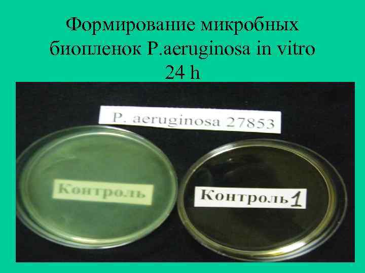 Формирование микробных биопленок P. aeruginosa in vitro 24 h 