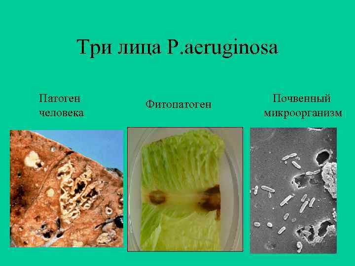 Три лица P. aeruginosa Патоген человека Фитопатоген Почвенный микроорганизм 