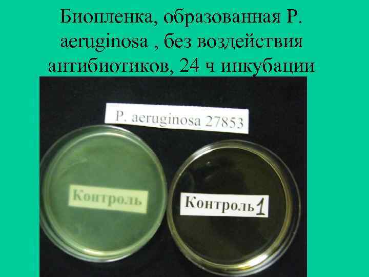 Биопленка, образованная P. aeruginosa , без воздействия антибиотиков, 24 ч инкубации 