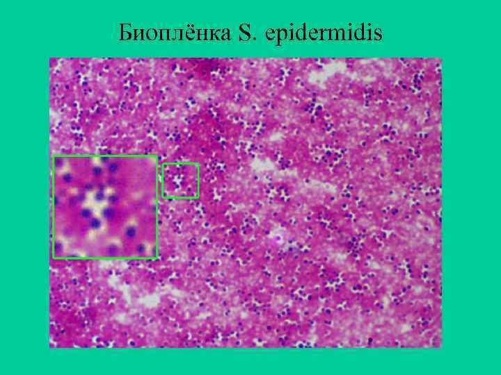 Биоплёнка S. epidermidis 