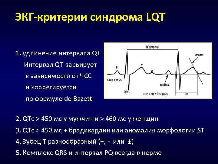 ЭКГ-критерии синдрома LQT 1. удлинение интервала QT Интервал QT варьирует в зависимости от ЧСС