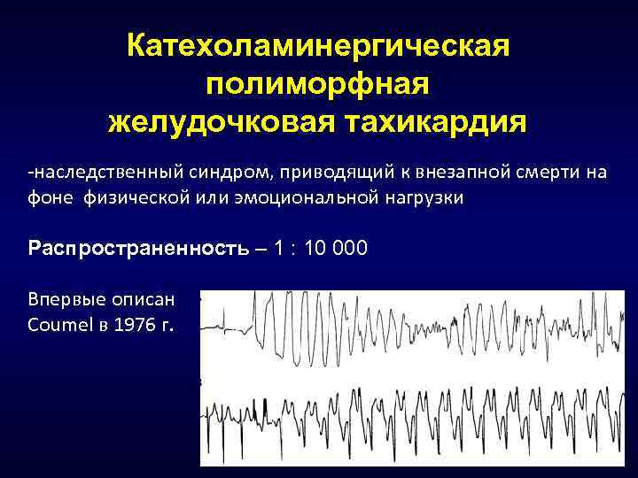 Катехоламинергическая полиморфная желудочковая тахикардия -наследственный синдром, приводящий к внезапной смерти на фоне физической или