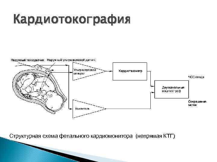 Кардиотокография Структурная схема фетального кардиомонитора (непрямая КТГ) 