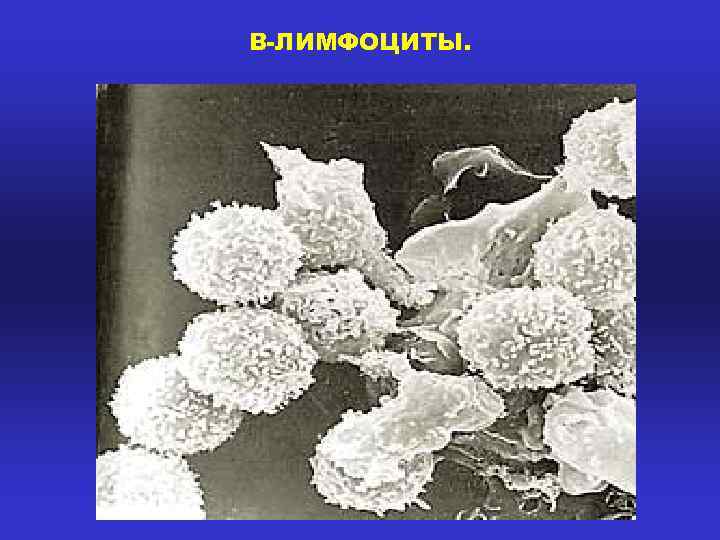В-ЛИМФОЦИТЫ. 
