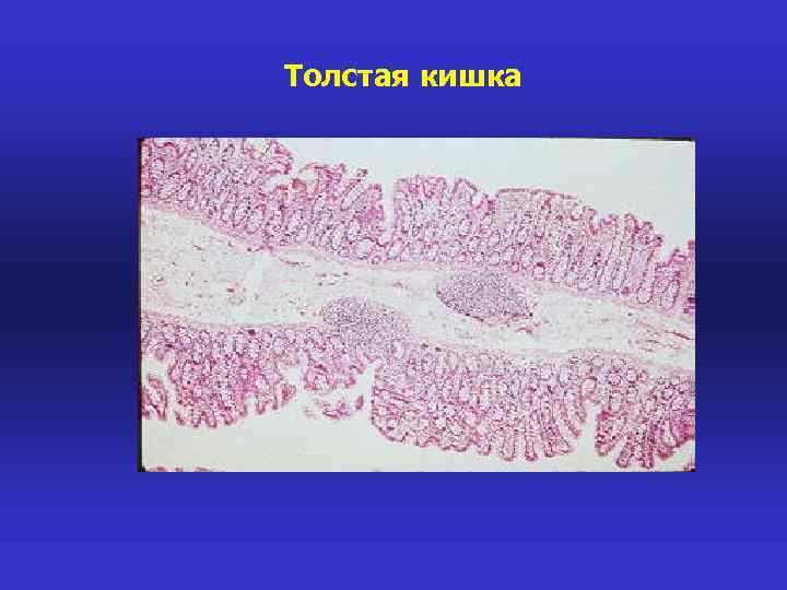 Толстая кишка 