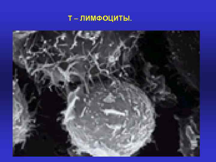 Т – ЛИМФОЦИТЫ. 
