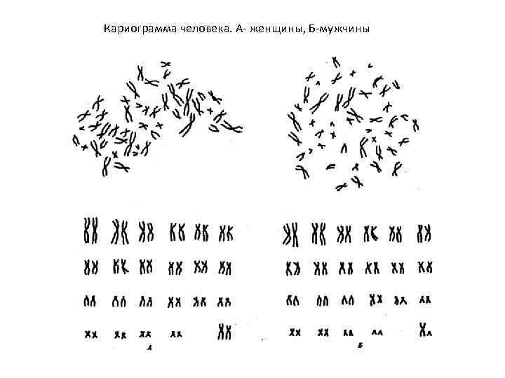 Кариограмма человека. А- женщины, Б-мужчины 