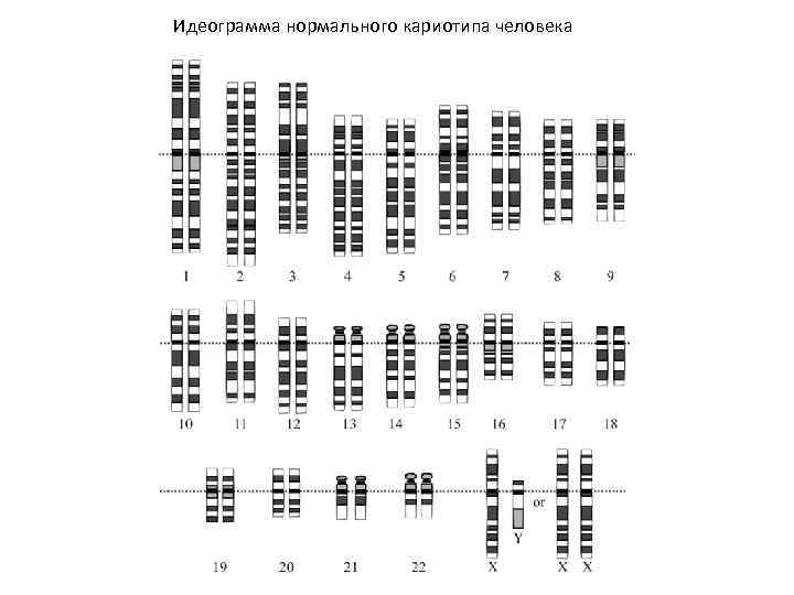 Идеограмма нормального кариотипа человека 