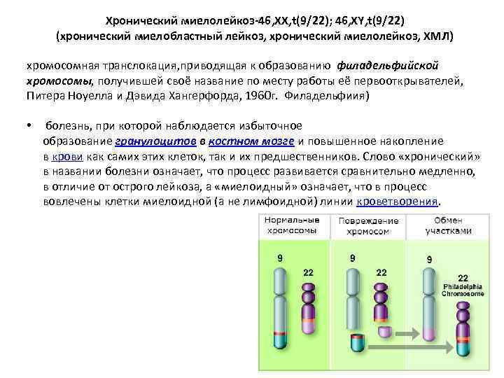 Хронический миелолейкоз-46, ХХ, t(9/22); 46, ХY, t(9/22) (хронический миелобластный лейкоз, хронический миелолейкоз, ХМЛ) хромосомная