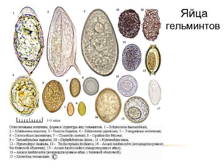 Яйца гельминтов 