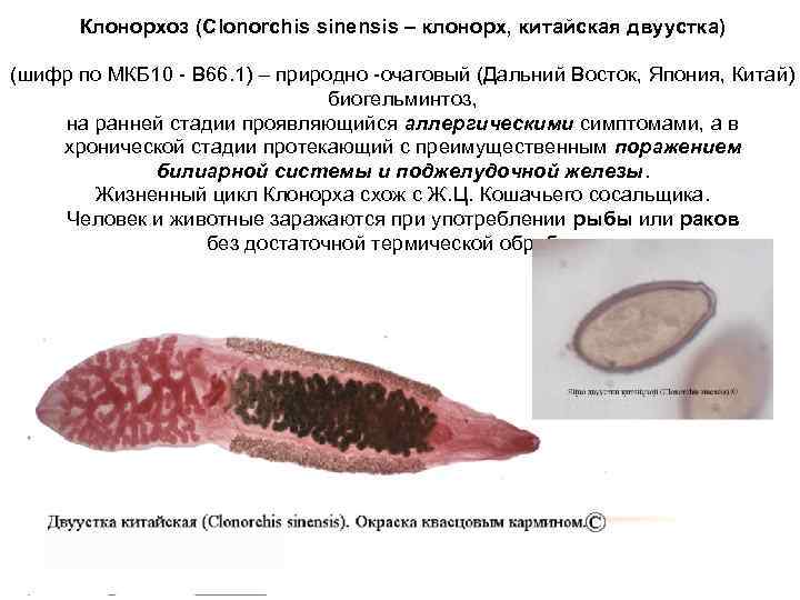 Клонорхоз (Clonorchis sinensis – клонорх, китайская двуустка) (шифр по МКБ 10 - B 66.
