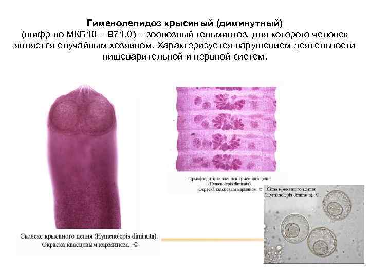 Гименолепидоз крысиный (диминутный) (шифр по МКБ 10 – B 71. 0) – зоонозный гельминтоз,