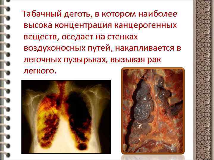 Табачный деготь, в котором наиболее высока концентрация канцерогенных веществ, оседает на стенках воздухоносных путей,