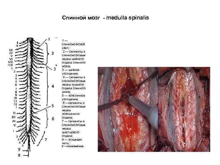 Спинной мозг - medulla spinalis 1— спинномозговой узел; 2 — сегменты и спинномозговые нервы