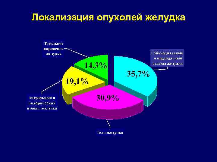 Локализация опухолей желудка 14, 3% 19, 1% 30, 9% 35, 7% 