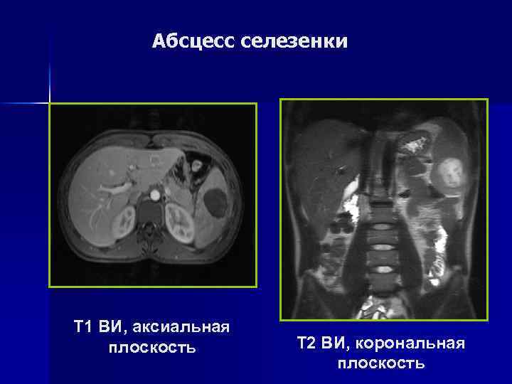 Показания и противопоказания к выполнению МРТ брюшной полости: n n МРТ целесообразно проводить всем