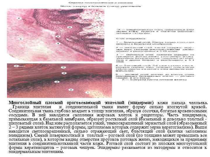 Многослойный плоский ороговевающий эпителий (эпидермис) кожи пальца человека. Граница эпителия и соединительной ткани имеет