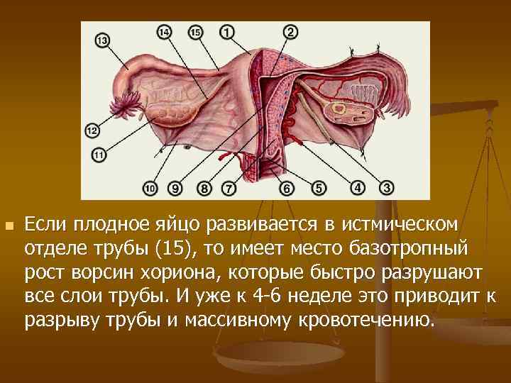 Клиническая картина разрыва маточной трубы