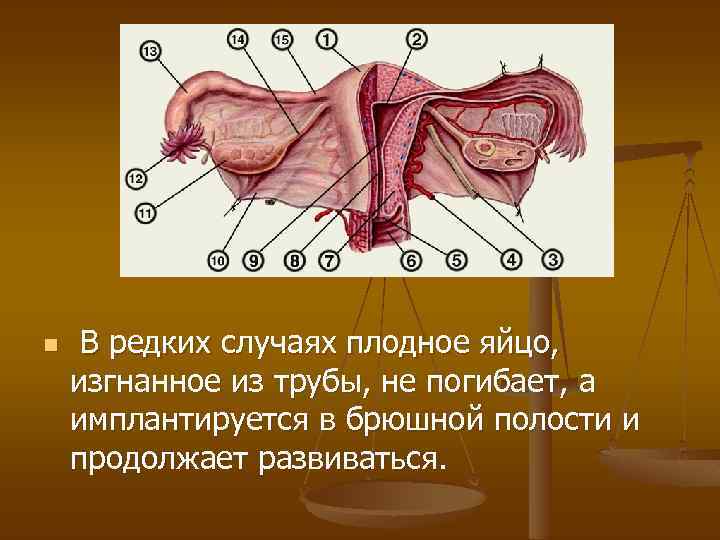 Абортцанг в гинекологии фото