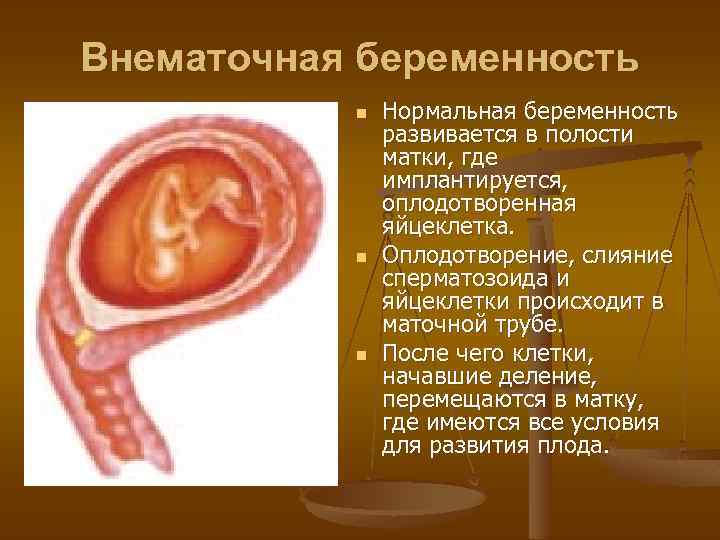 Видео где забеременеть. Внематочная беременность. Внематочная беременность развивается в. Внематочная беременность и нормальная. Оплодотворенная яйцеклетка в полости матки.