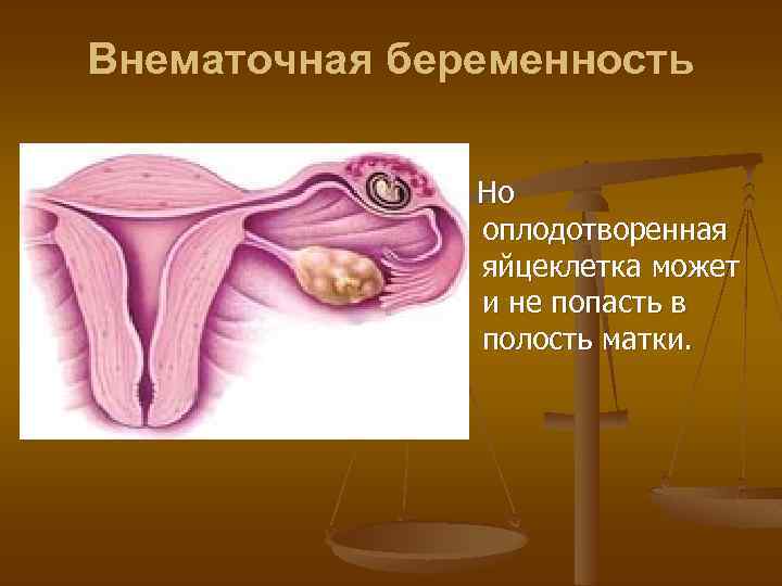 Внематочная беременность Но оплодотворенная яйцеклетка может и не попасть в полость матки. 