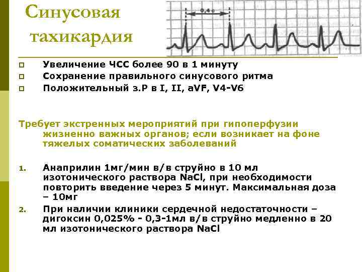 Синусовая тахикардия p p p Увеличение ЧСС более 90 в 1 минуту Сохранение правильного