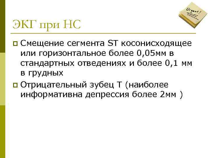 ЭКГ при НС Смещение сегмента ST косонисходящее или горизонтальное более 0, 05 мм в