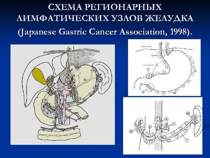 Лимфатические узлы желудка схема