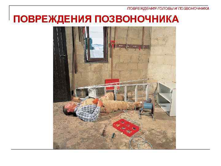 ПОВРЕЖДЕНИЯ ГОЛОВЫ И ПОЗВОНОЧНИКА ПОВРЕЖДЕНИЯ ПОЗВОНОЧНИКА 