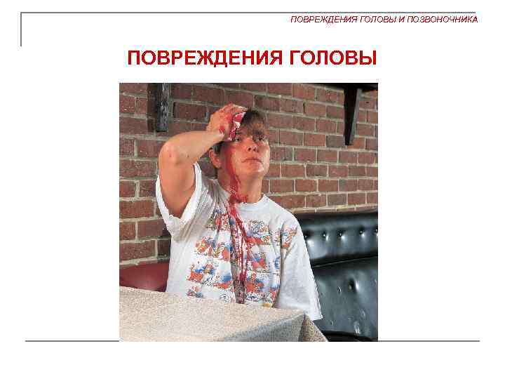 ПОВРЕЖДЕНИЯ ГОЛОВЫ И ПОЗВОНОЧНИКА ПОВРЕЖДЕНИЯ ГОЛОВЫ 