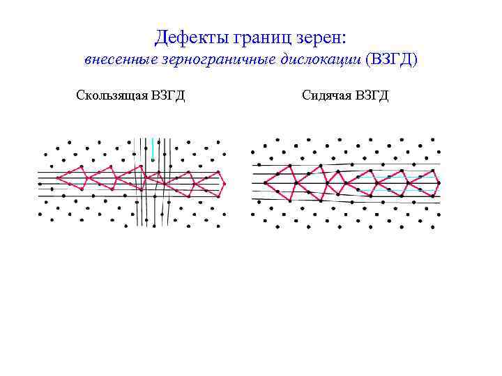 Дефекты границ зерен: внесенные зернограничные дислокации (ВЗГД) Скользящая ВЗГД Сидячая ВЗГД 