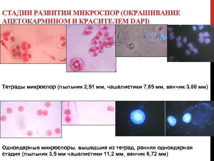 СТАДИИ РАЗВИТИЯ МИКРОСПОР (ОКРАШИВАНИЕ АЦЕТОКАРМИНОМ И КРАСИТЕЛЕМ DAPI) Тетрады микроспор (пыльник 2, 51 мм,