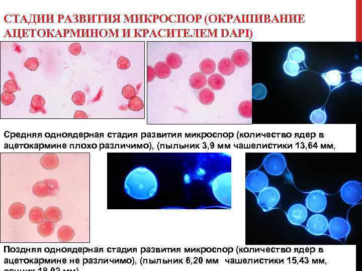 СТАДИИ РАЗВИТИЯ МИКРОСПОР (ОКРАШИВАНИЕ АЦЕТОКАРМИНОМ И КРАСИТЕЛЕМ DAPI) Средняя одноядерная стадия развития микроспор (количество