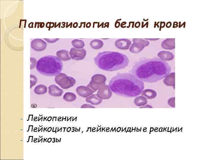 Патофизиология белой крови Лейкопении - Лейкоцитозы, лейкемоидные реакции - Лейкозы - 